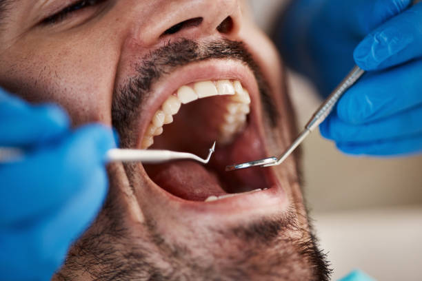 Best Pediatric Emergency Dentist in Lake Lorelei, OH